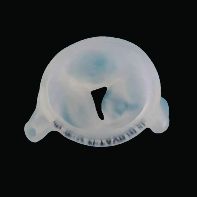 主动脉瓣疾病模型