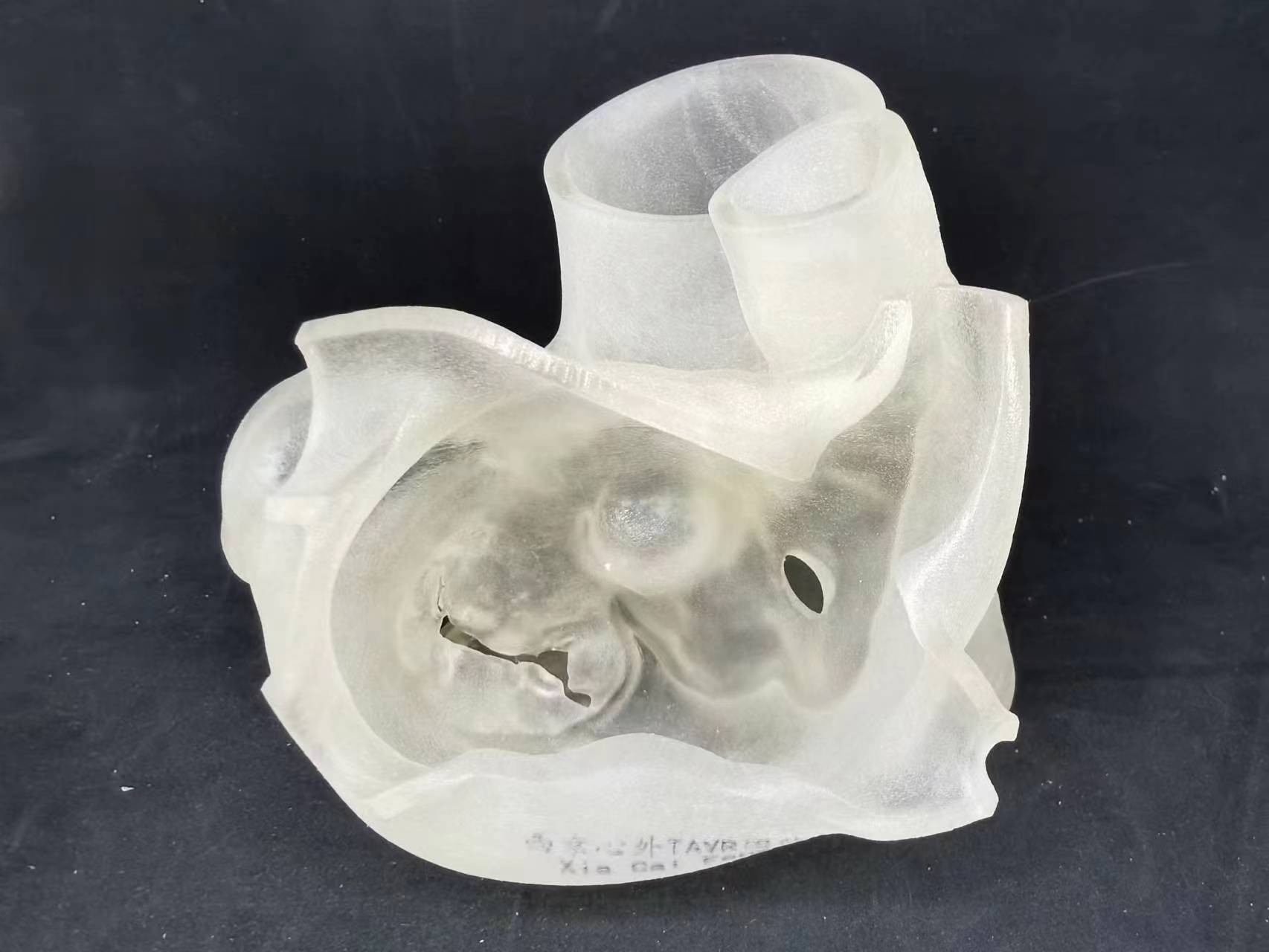 二尖瓣疾病模型